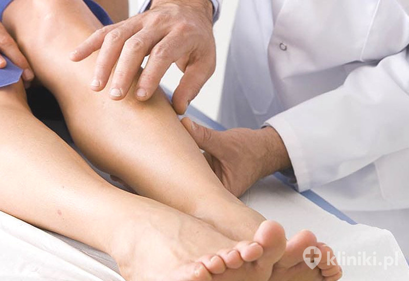 Usuwanie pajączków metodą skleroterapii