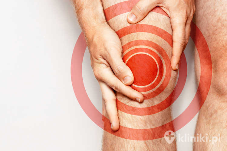 Rekonstrukcja ACL metodą artroskopową