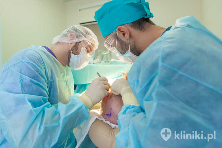 Zabieg transplantacji włosów