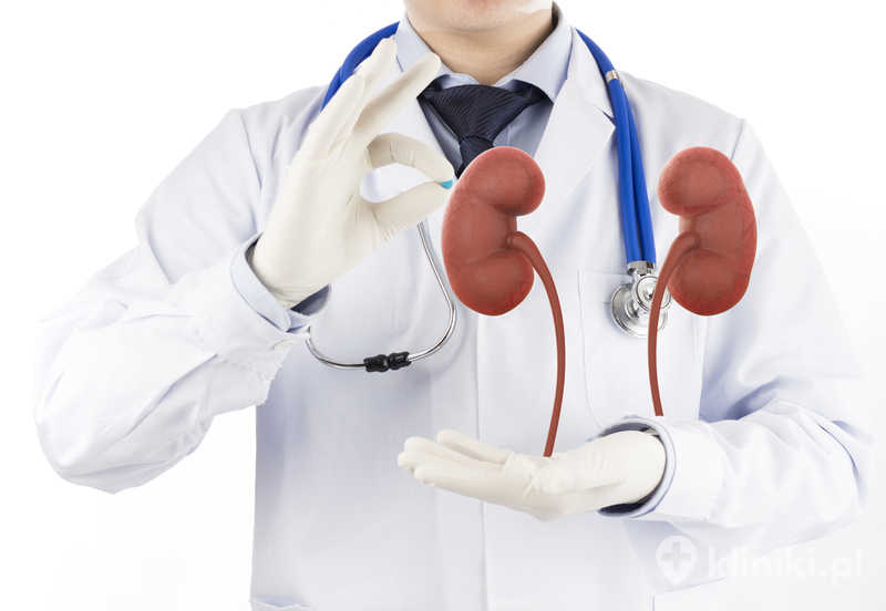 Objawy kamicy nerkowej