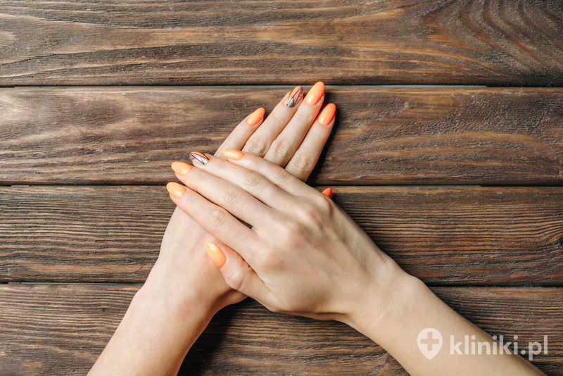 Leczenie choroby Dupuytrena może obejmować iniekcje kolagenazy, które rozluźniają patologiczne pasma Leczenie choroby Dupuytrena może obejmować iniekcje kolagenazy, które rozluźniają patologiczne pasma