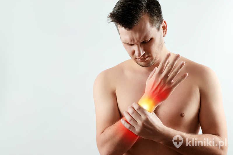 Operacja otwarta zespołu cieśni kanału nadgarstka przynosi szybkie złagodzenie drętwienia i bólu u większości pacjentów