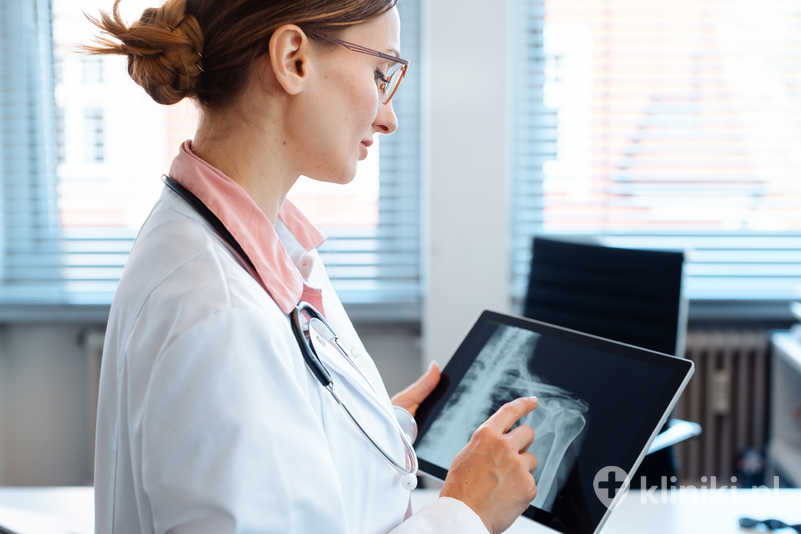 USG barku pozwala ocenić ścięgna, mięśnie, kaletki oraz obecność płynu w stawie