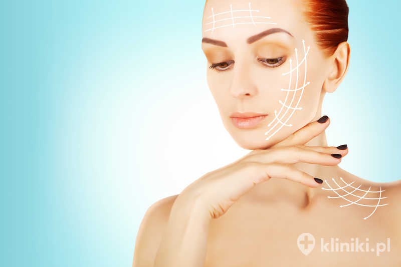 Chirurgiczny lifting twarzy i szyi pozwala na redukcję wiotkości skóry oraz głębszych tkanek