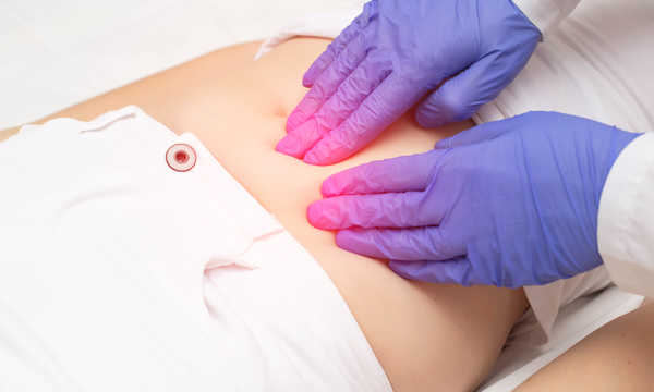 Operacja torbieli jajnika laparoskopowo wiąże się z mniejszym bólem pooperacyjnym niż zabieg klasyczny