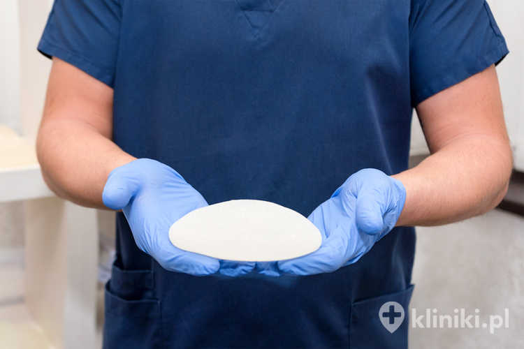 Implanty piersi czasami wymagają wymiany z powodów estetycznych, np. zmiany kształtu lub opadania