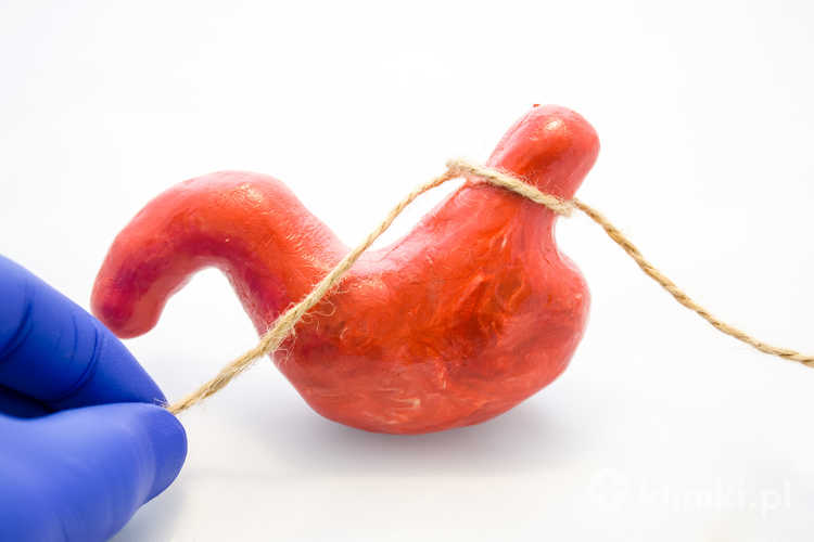 Bariatria obejmuje zarówno metody zachowawcze, jak i chirurgiczne, w tym operacje bariatryczne zmniejszające objętość żołądka