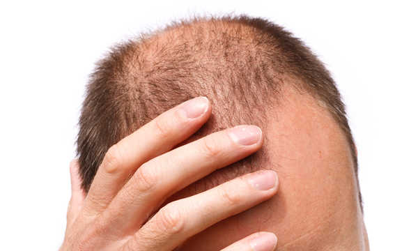 Zabieg DR.CYJ Hair Filler - informacje o terapii