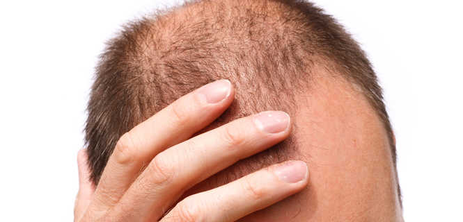 Zabieg DR.CYJ Hair Filler - informacje o terapii
