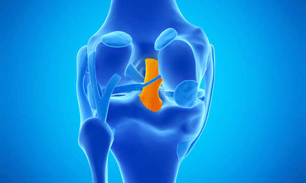 Artroskopowa operacja więzadła krzyżowego tylnego (PCL) jest małoinwazyjnym zabiegiem ortopedycznym wykonywanym w celu przywrócenia stabilności stawu kolanowego