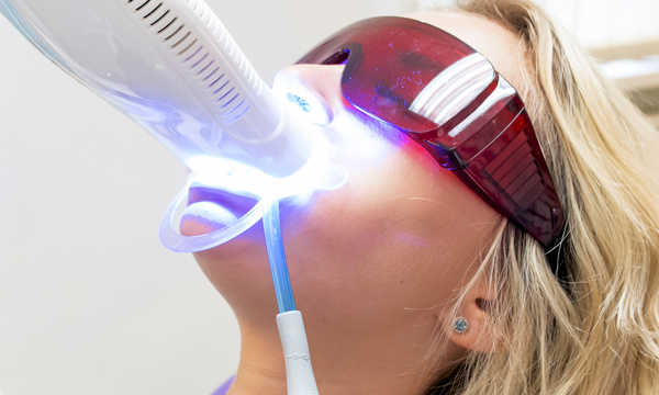 Wybielanie zębów laserem - jak to dziala?