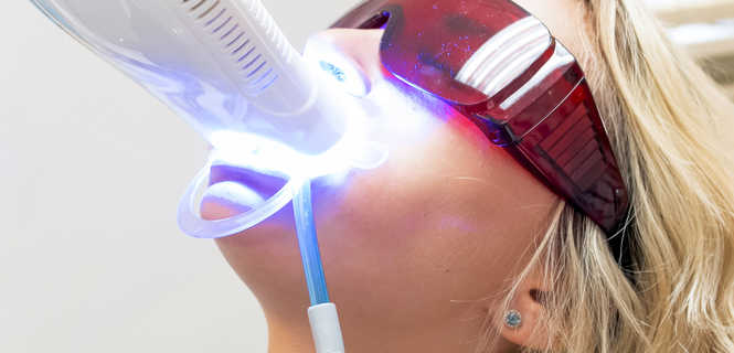 Wybielanie zębów laserem - jak to dziala?