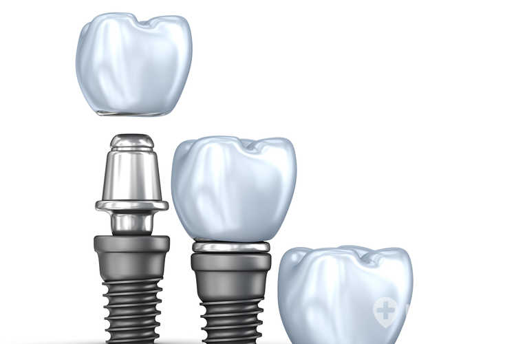 implantacja wczesna