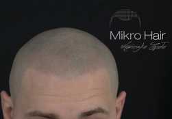 MikroHair, Julianów - opinie i cennik 2025