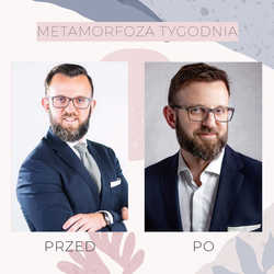 Przeszczep włosów FUE u mężczyzn przed i po zabiegu