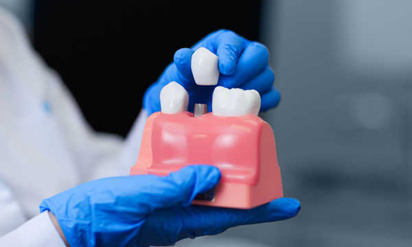 Implanty zębowe Dentium