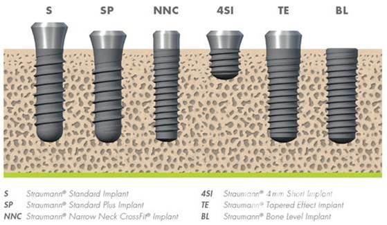 Rodzaje implantów Straumann