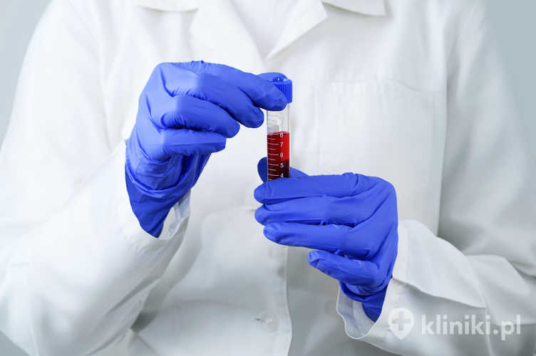 Badania diagnostyczne przed operacją powiek są bardzo ważnym elementem leczenia