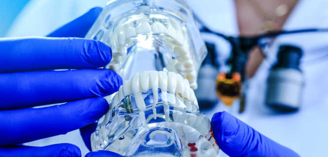 Implanty zębowe Astra Tech