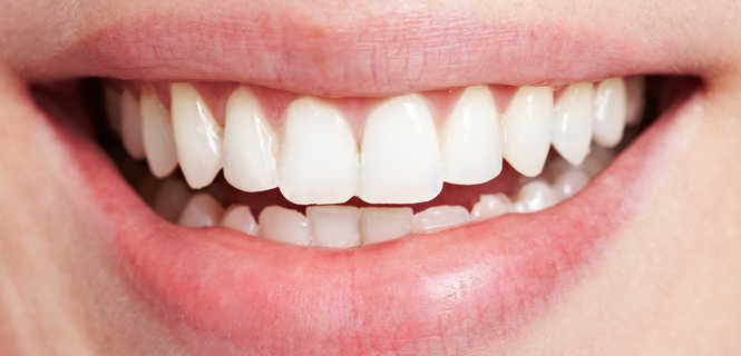 Leczenie na raty - implanty zębowe