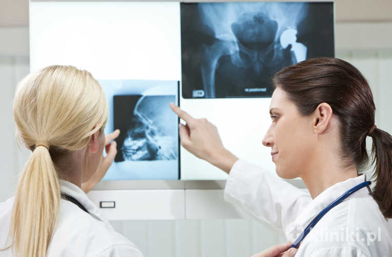 Wybór między całkowitą a częściową endoprotezoplastyką biodra zawsze zależy od indywidualnej oceny ortopedycznej