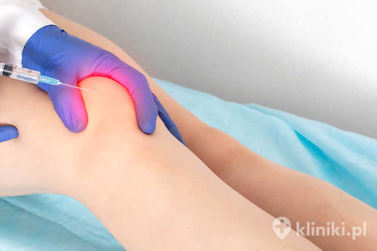 Korzyści i ograniczenia terapii Vivostat PRF