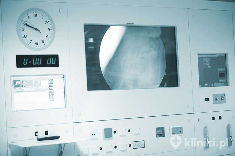 Nowoczesna artroskopia kolana w Polsce