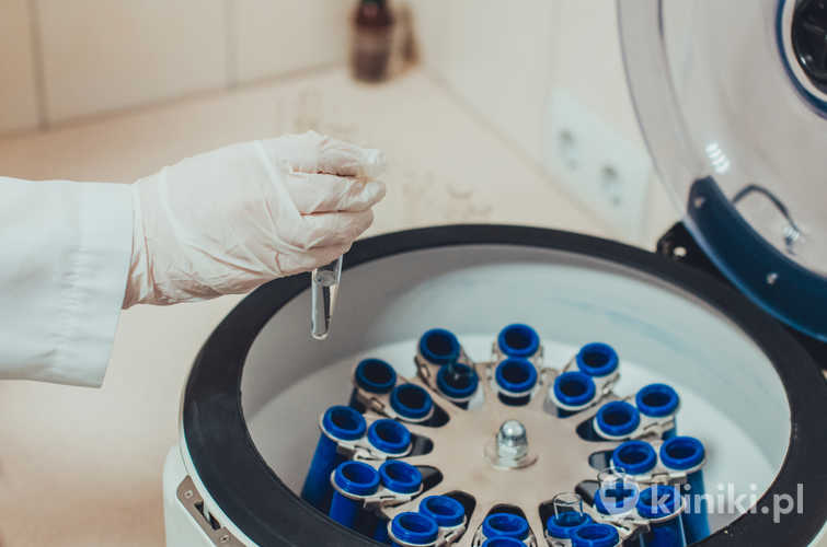 osocze bogatopłytkowe