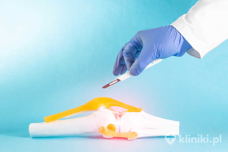 Rekonwalescencja po artroskopii kolana