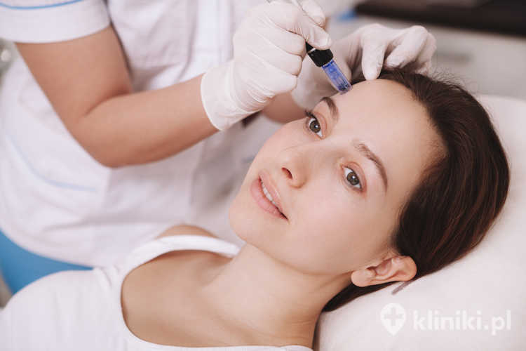 Dermapen efekty.