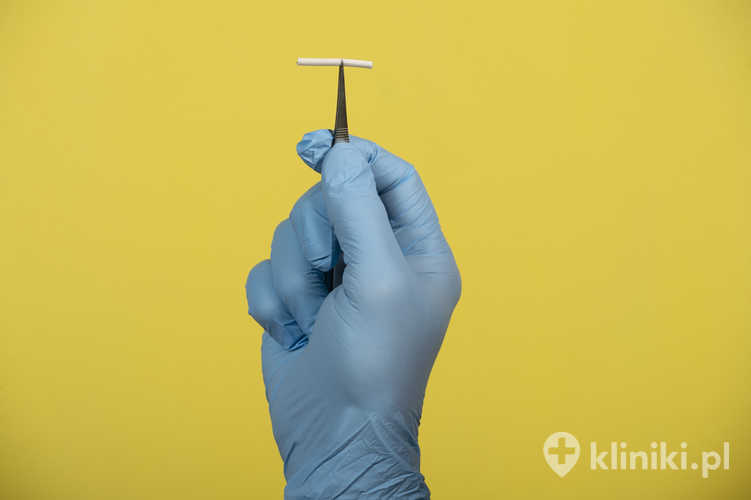 Implant antykoncepcyjny