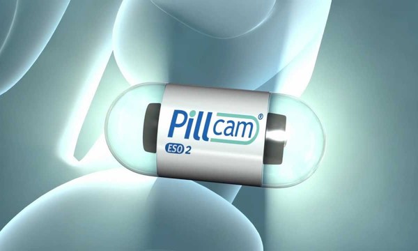 PillCam bezinwazyjna endoskopia kapsułkowa