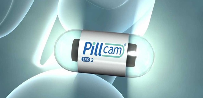 PillCam bezinwazyjna endoskopia kapsułkowa