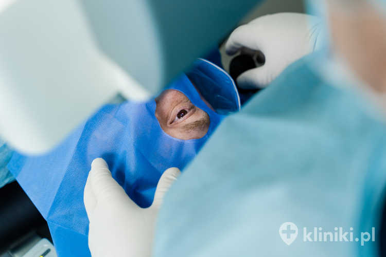 Leczenie jaskry metodą irydektomii jest najczęściej stosowane u pacjentów z jaskrą z zamykającym się lub zamkniętym kątem przesączania