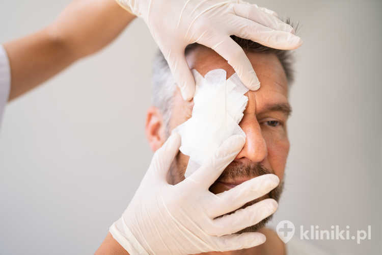 Zabieg irydektomii w leczeniu jaskry jest procedurą stosunkowo krótką i wykonywaną w znieczuleniu miejscowym