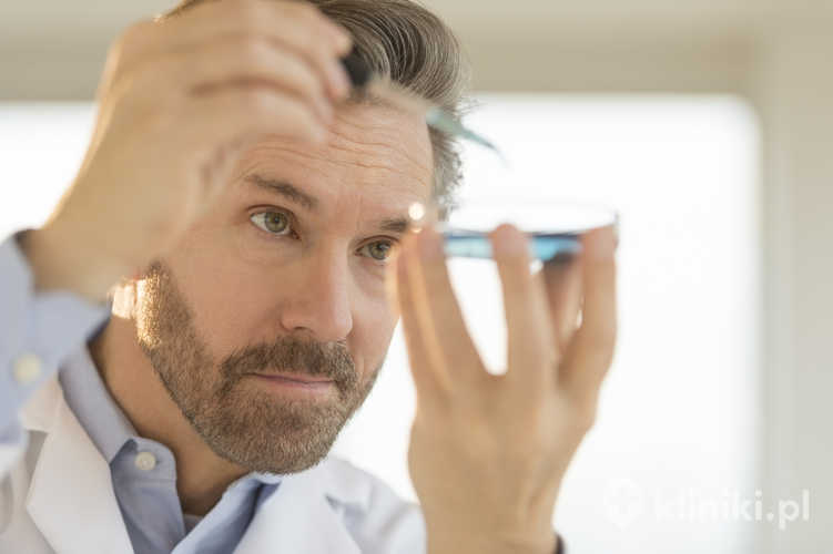 Zastosowanie komórek macierzystych w łysieniu może ograniczać stan zapalny okołomieszkowy