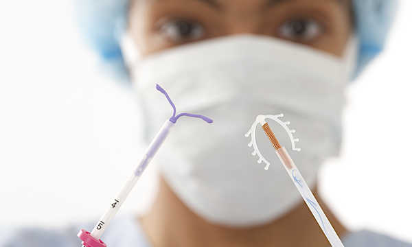 Gynefix - niehormonalna wkładka domaciczna