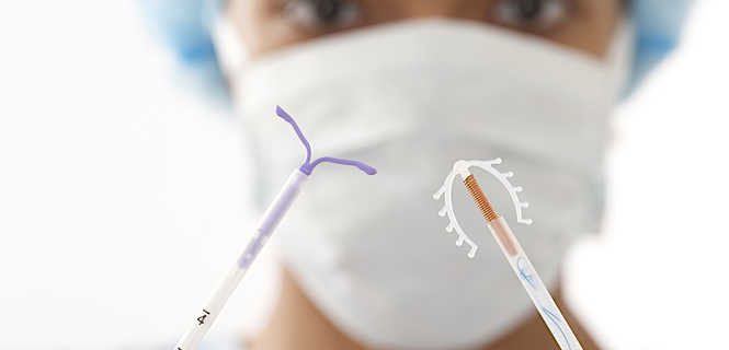 Gynefix - niehormonalna wkładka domaciczna