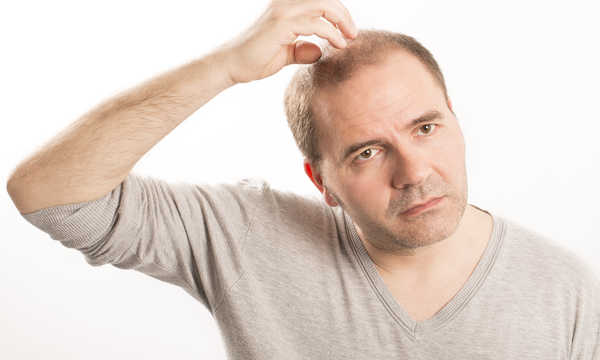 Przeszczep włosów - metoda FUE
