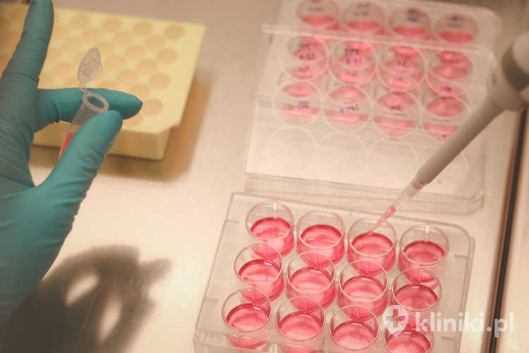 Schorzenia leczone przy pomocy komórek macierzystych Angel System mogą wspierać leczenie uszkodzeń łąkotek w stawie kolanowym