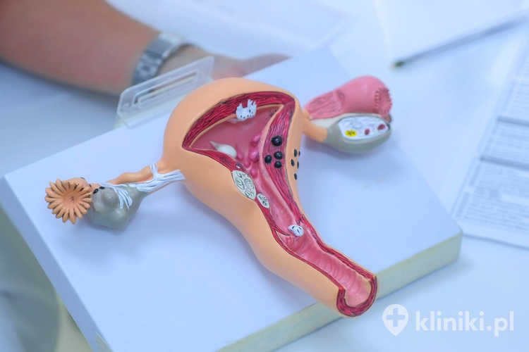 Konsultacja ginekologiczna jest wskazana w przypadku niepokojących objawów, takich jak ból podbrzusza czy nieregularne miesiączki