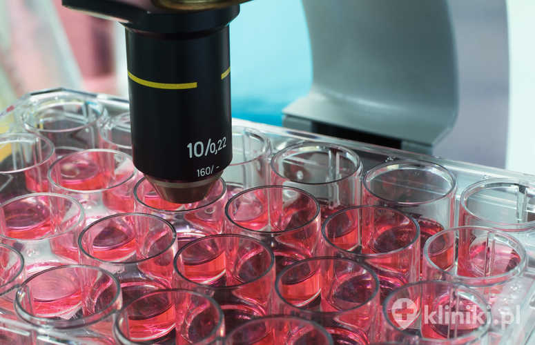 Cytologia płynna umożliwia uzyskanie lepszej jakości materiału diagnostycznego niż klasyczny rozmaz