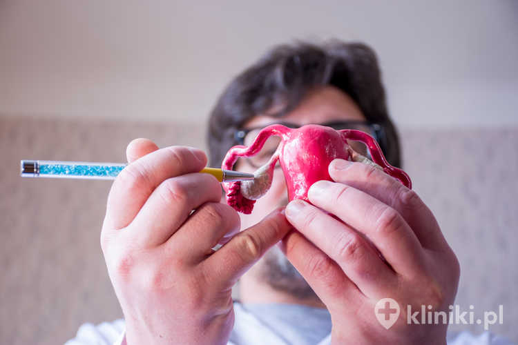 Elektrokauteryzacja jajników (skaryfikacja) może poprawić równowagę hormonalną i zwiększyć szansę na naturalną ciążę