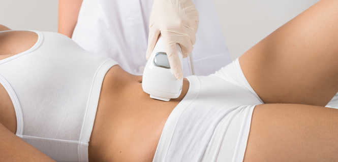 LipoCryo – nowoczesna kriolipoliza na brzuch, uda i pośladki