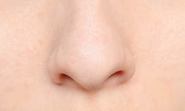 Leczenie guzowatości nosa laserem