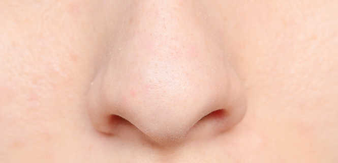 Leczenie guzowatości nosa laserem