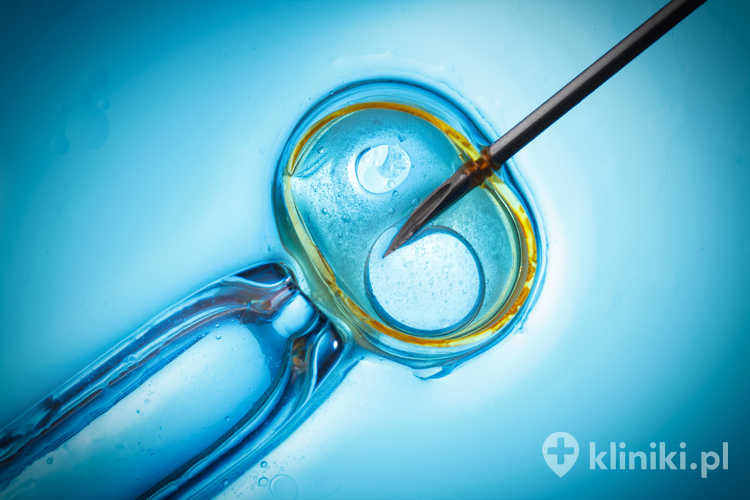 Procedura in vitro