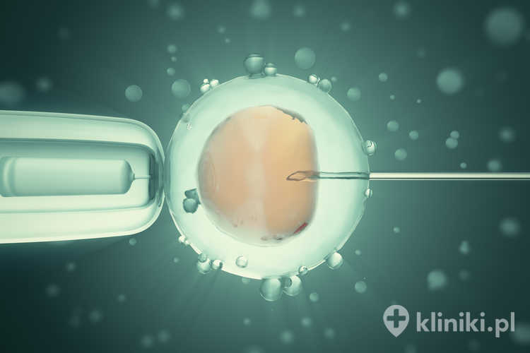 Diagnostyka preimplantacyjna PGT