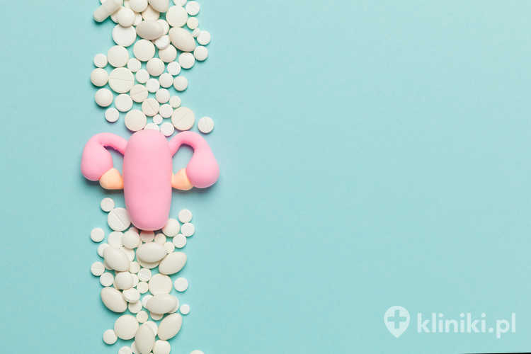 Leczenie mięśniaków macicy