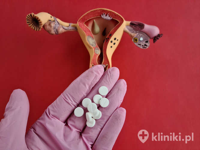 Mięśniaki macicy